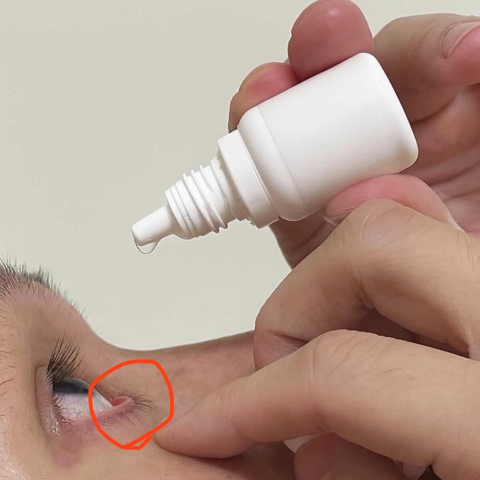 May be an image of tick