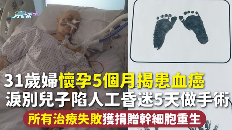 血癌｜31岁妇怀孕5个月揭患血癌 泪别儿子陷人工昏迷5天做手术 所有治疗失败获捐赠干细胞重生