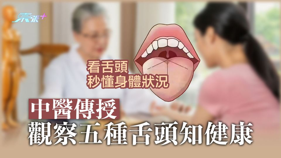 看舌頭秒懂身體狀況 中醫傳授觀察五種舌頭知健康 