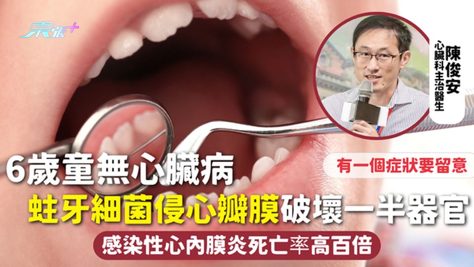 蛀牙 | 6歲童無心臟病 蛀牙細菌侵心瓣膜破壞一半器官 感染性心內膜炎死亡率高百倍 有一個症狀要留意