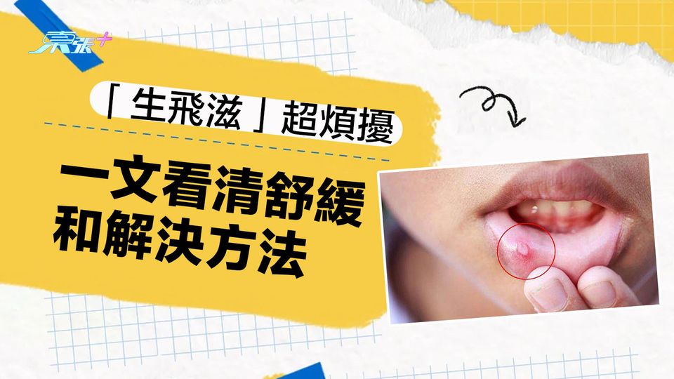 「生痱滋」超煩擾 一文看清舒緩和解決方法