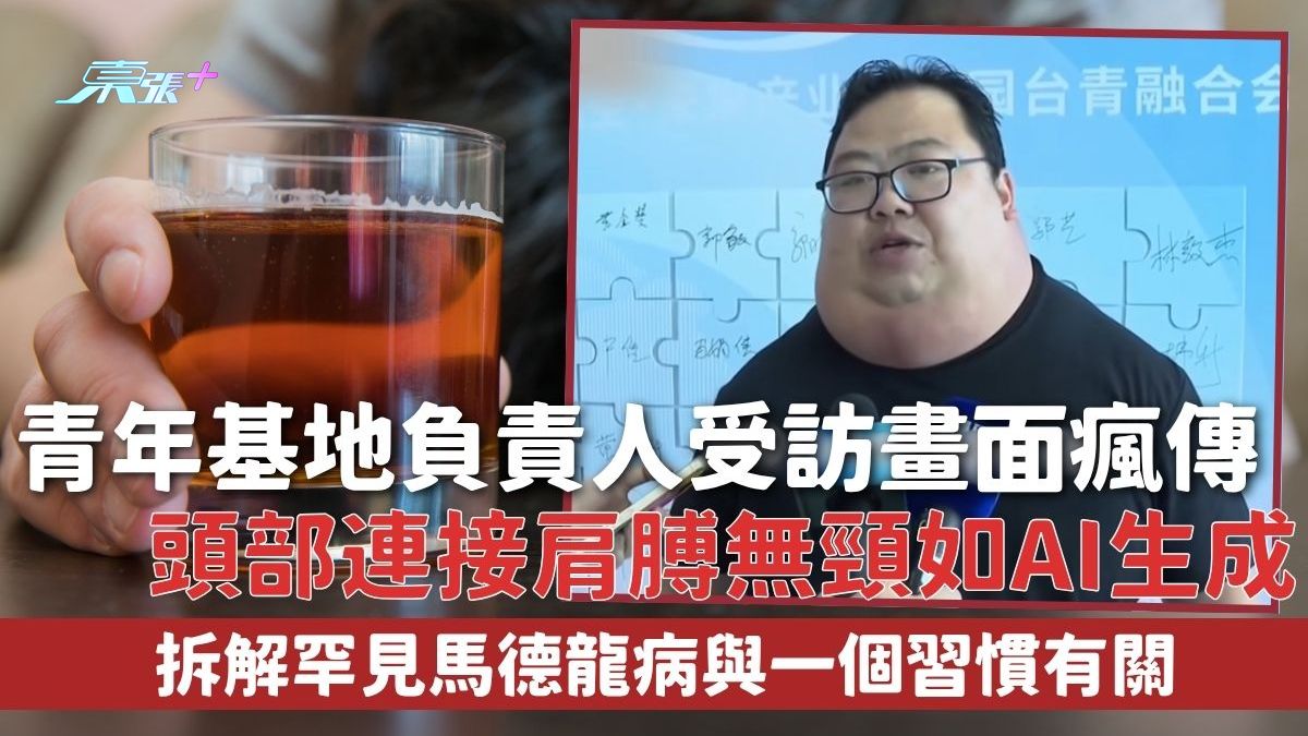 馬德龍病｜青年基地負責人受訪畫面瘋傳 頭部連接肩膊無頸如AI生成 拆解罕見馬德龍病與一個習慣有關
