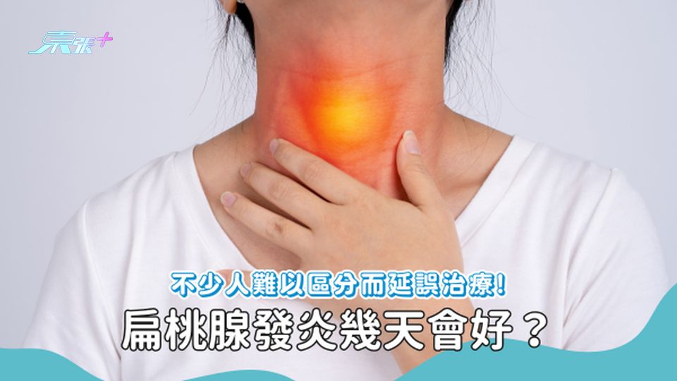 扁桃腺發炎和喉嚨發炎有何分別？會傳染嗎？由醫生分享治療方法及護理貼士💡