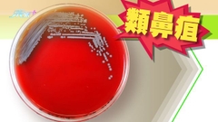 當局過去一周接獲多3宗類鼻疽呈報個案 患者均居深水埗