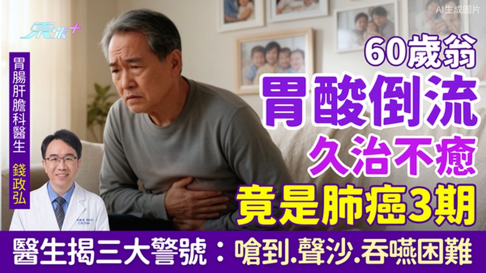 60歲翁胃酸倒流久治不癒竟是肺癌3期！腸胃醫生揭三大警號：嗆到、聲沙、吞嚥困難 