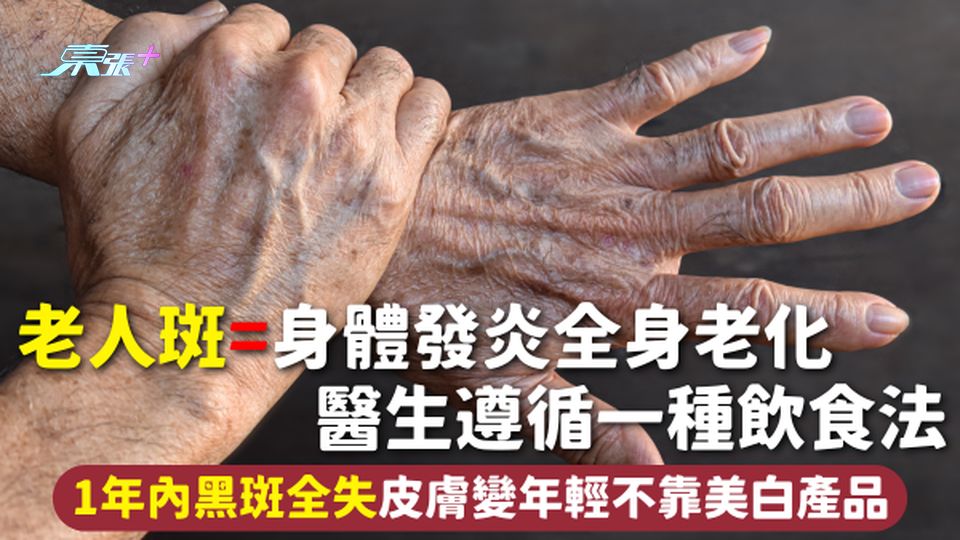 老人斑=身體發炎全身老化 醫生遵循一種飲食法 1年內黑斑全失皮膚變年輕不靠美白產品