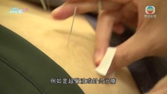 醫生指若長期坐骨神經痛 或屬椎間盤異常需治療