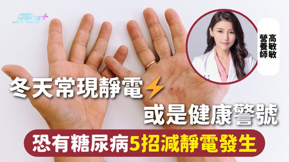 靜電 | 冬天常現靜電或是健康警號⚡ 恐有糖尿病5招減靜電發生