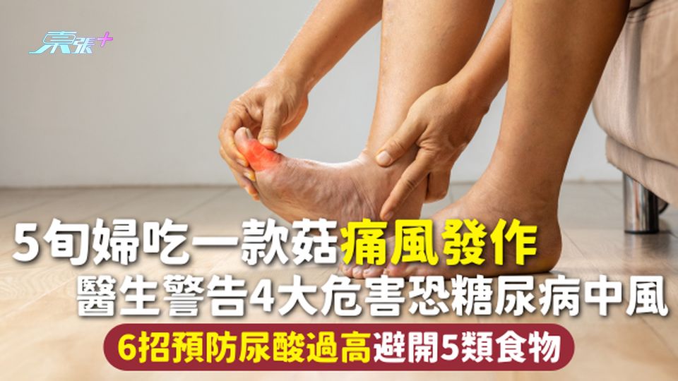 飲食健康 | 5旬婦吃一款菇痛風發作 醫生警告4大危害恐糖尿病中風 6招預防尿酸過高避開5類食物