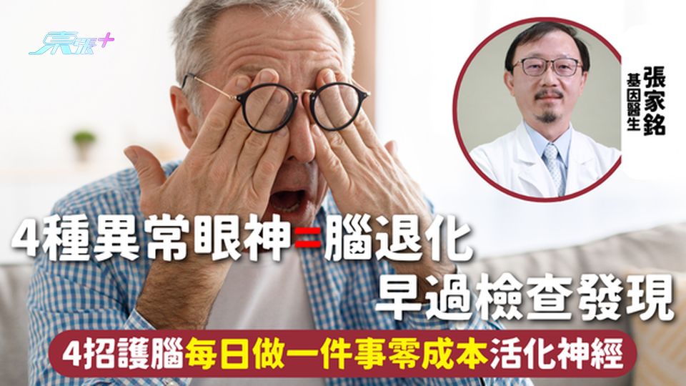 腦退化 | 4種異常眼神=腦退化 早過檢查發現 4招護腦每日做一件事零成本活化神經