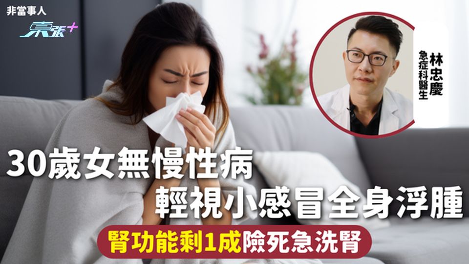 腎臟健康 | 30歲女無慢性病 輕視小感冒全身浮腫 腎功能剩1成險死急洗腎