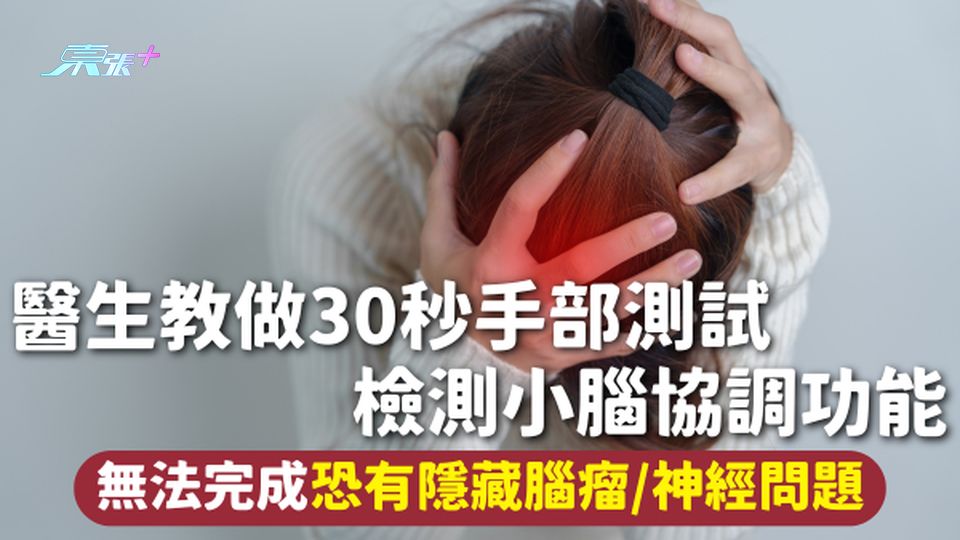 腦部健康 | 醫生教做30秒手部測試 檢測小腦協調功能 無法完成恐有隱藏腦瘤/神經問題