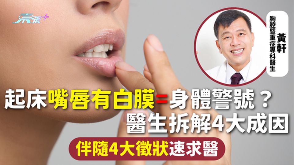 嘴唇白膜 | 起床嘴唇有白膜=身體警號？醫生拆解4大成因 伴隨4大徵狀速求醫 