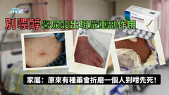 別嘌醇醫尿酸出現嚴重副作用 家屬：原來有種藥會折磨一個人到咁先死！