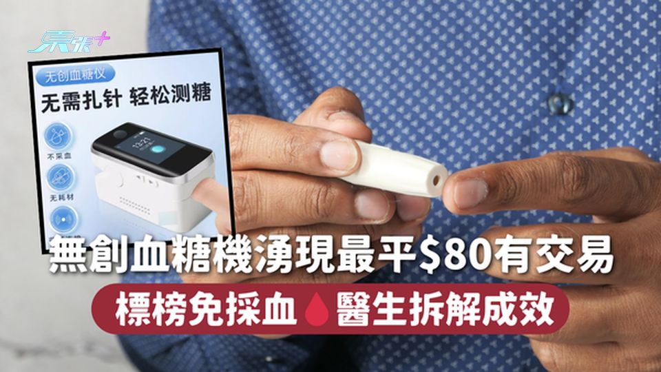 無創血糖機湧現最平$80有交易 標榜免採血🩸醫生拆解成效