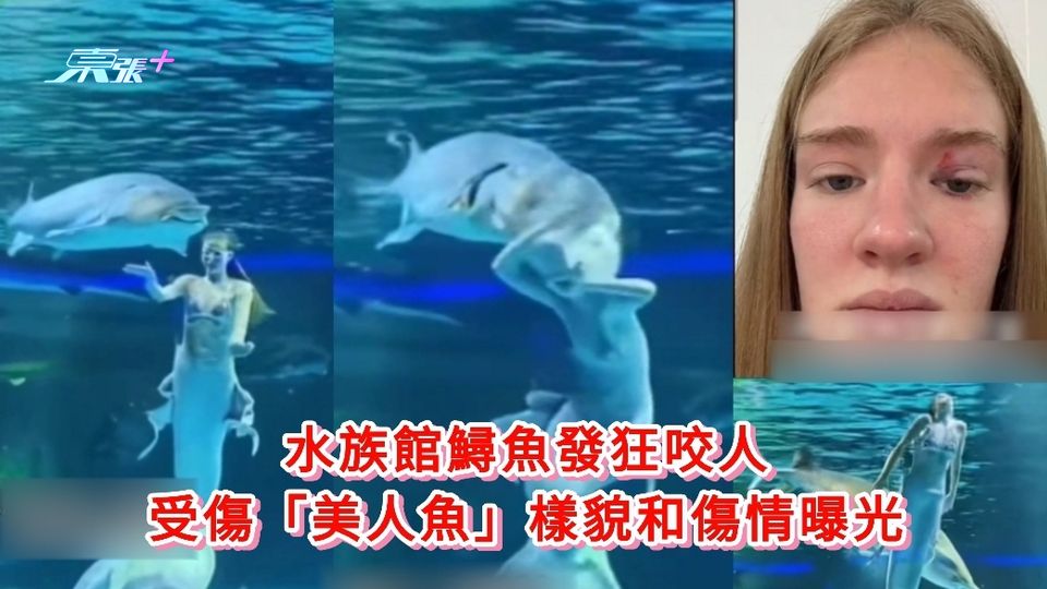 有片|水族館鱘魚發狂咬人 受傷「美人魚」樣貌和傷情曝光