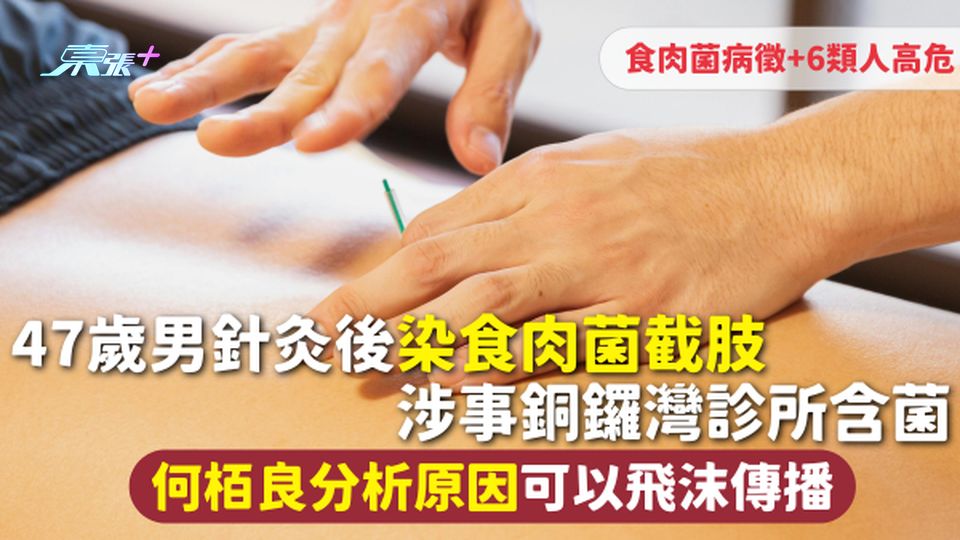 47歲男針灸後染食肉菌截肢 涉事銅鑼灣診所含菌 何栢良分析原因可以飛沫傳播 食肉菌病徵+6類人高危