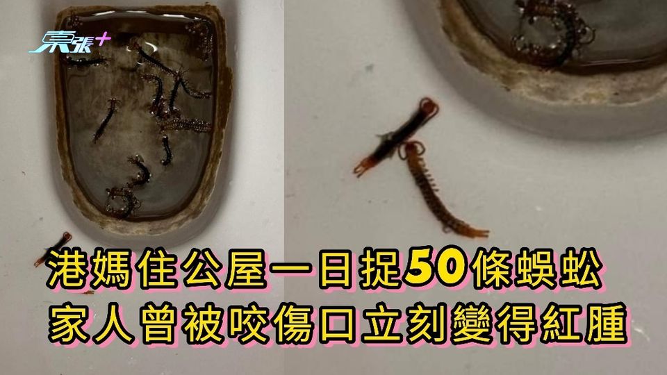 港媽住公屋一日捉50條蜈蚣 家人曾被咬傷口立刻變得紅腫