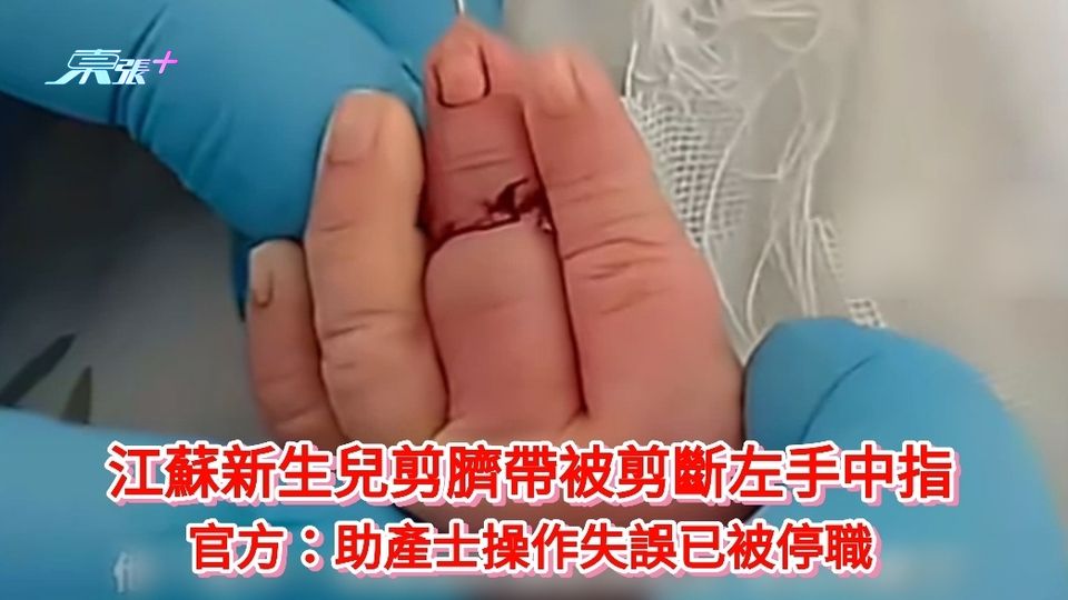江蘇新生兒剪臍帶被剪斷左手中指 官方：助產士操作失誤已被停職