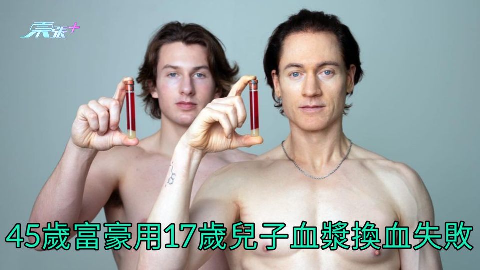 45歲富豪用17歲兒子血漿換血失敗