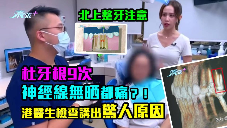 北上整牙注意｜杜牙根9次神經線無晒都痛？！港醫生檢查講出驚人原因
