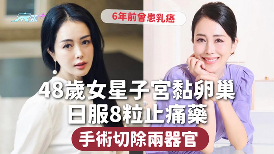 子宮內膜異位症 | 48歲女星子宮黏卵巢 日服8粒止痛藥 手術切除兩器官