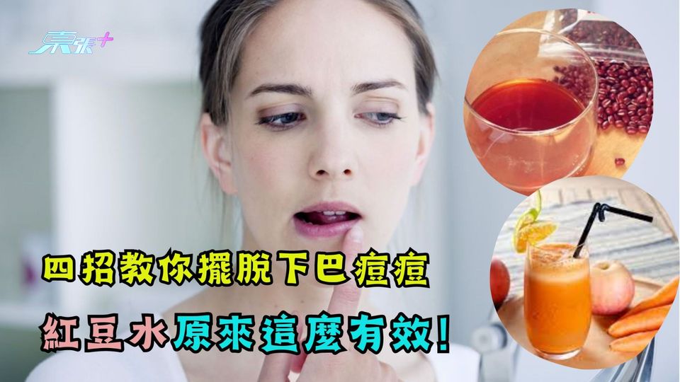 四招教你擺脫下巴痘痘 紅豆水原來這麼有效！