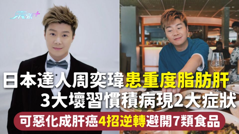脂肪肝 | 日本達人周奕瑋患重度脂肪肝 3大壞習慣積病現2大症狀 可惡化成肝癌4招逆轉避開7類食品
