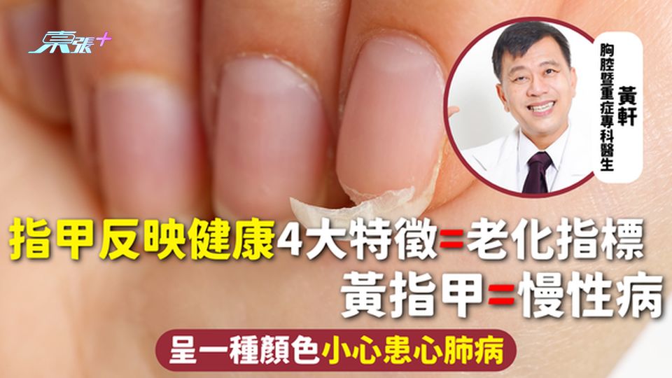 指甲健康 | 指甲反映健康 4大特徵=老化指標 黃指甲=慢性病 呈一種顏色小心患心肺病 