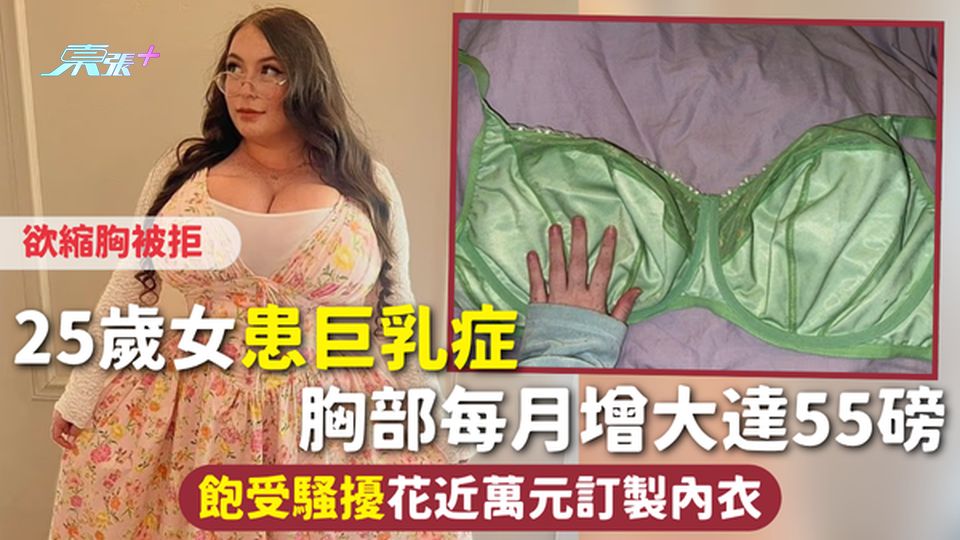 巨乳症 | 25歲女患巨乳症 胸部每月增大達55磅 飽受騷擾花近萬元訂製內衣 欲縮胸被拒