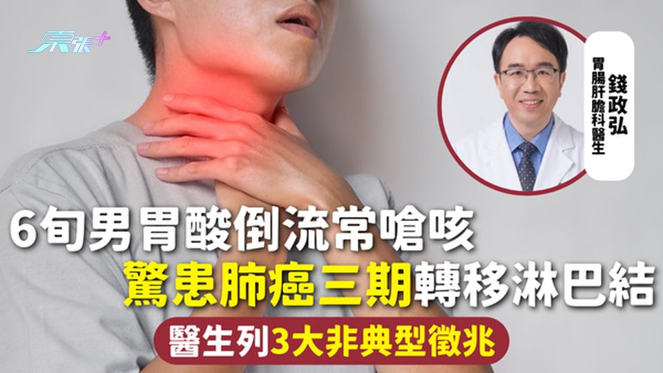 肺癌 | 6旬男胃酸倒流常嗆咳 驚患肺癌三期轉移淋巴結 醫生列3大非典型徵兆