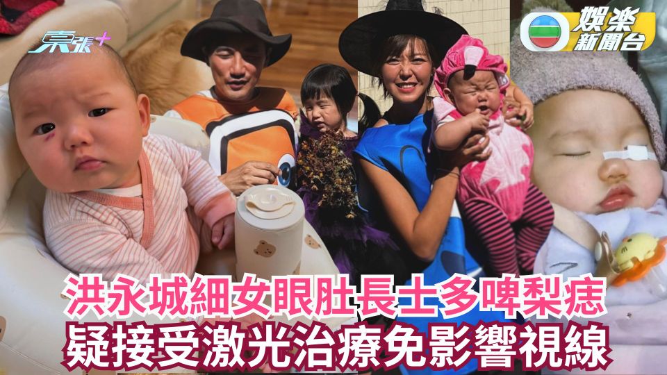 洪永城細女眼肚長士多啤梨痣 疑接受激光治療免影響視線