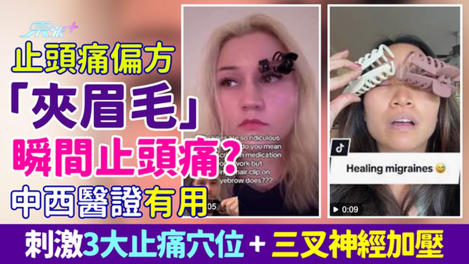 止頭痛偏方｜網絡爆紅「夾眉毛」瞬間止痛？中西醫證有用：刺激3大止痛穴位＋三叉神經加壓