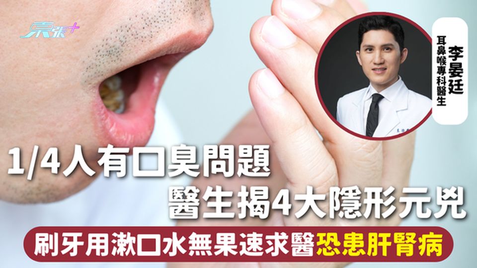 口臭 | 1/4人有口臭問題 醫生揭4大隱形元兇 刷牙用漱口水無果速求醫恐患肝腎病 