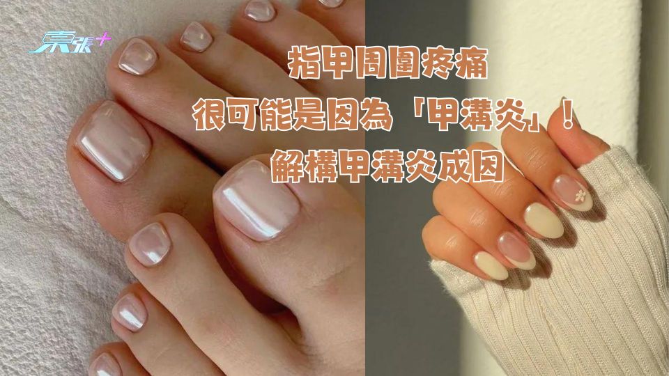 指甲周圍的疼痛 很可能是因為「甲溝炎」！解構甲溝炎成因 