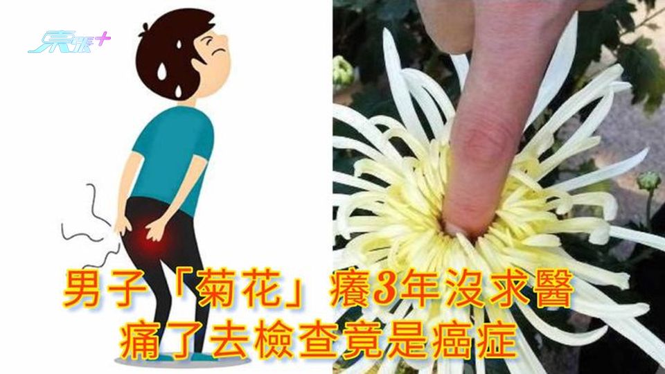 男子「菊花」癢3年沒求醫 痛了去檢查竟是癌症