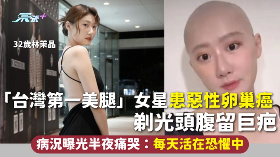 32歲「台灣第一美腿」女星患惡性卵巢癌 剃光頭腹留巨疤 病況曝光半夜痛哭：每天活在恐懼中