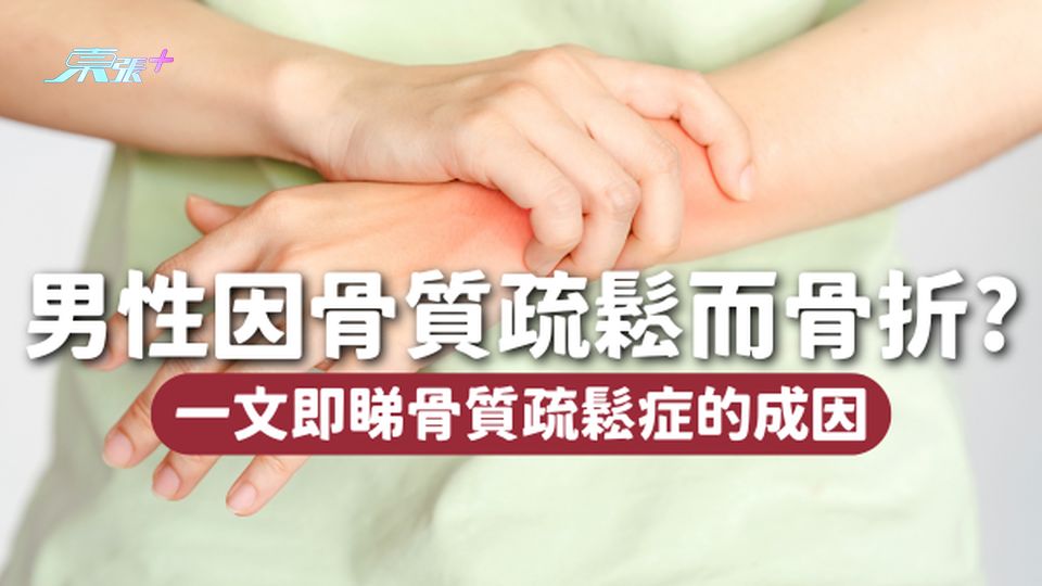 不止女性，約有1/4的男性在一生中會因骨質疏鬆症而骨折！成因大揭秘👉🏻