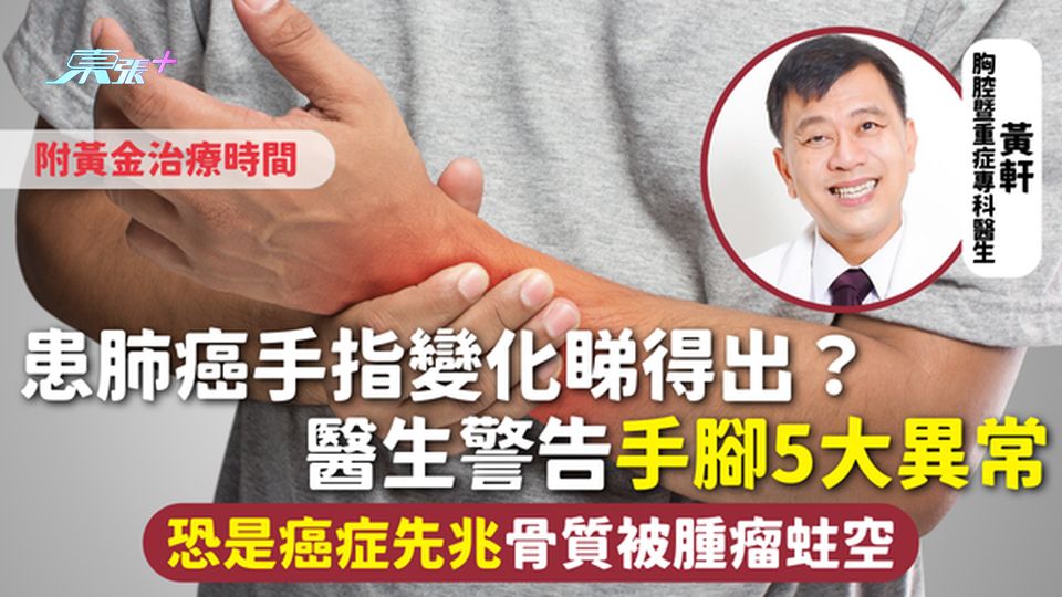癌症先兆 | 患肺癌手指變化睇得出？醫生警告手腳5大異常 恐是癌症先兆骨質被腫瘤蛀空 附黃金治療時間