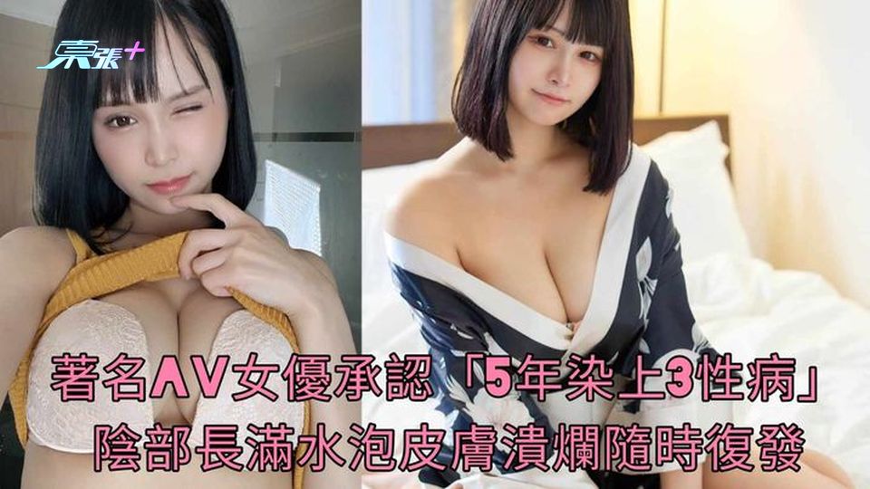 著名AV女優日向陽葵承認「5年染上3性病」 陰部長滿水泡皮膚潰爛隨時復發