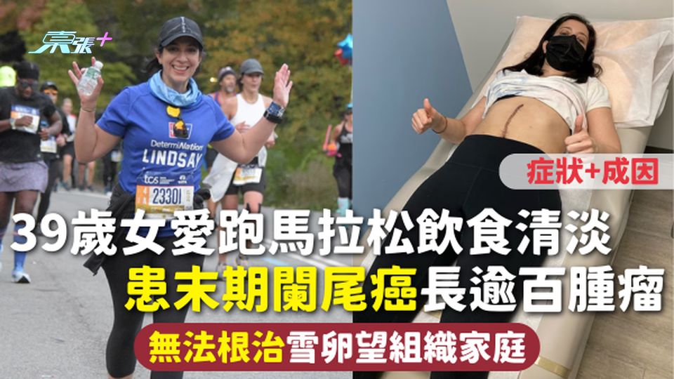 闌尾癌 | 39歲女愛跑馬拉松飲食清淡 患末期闌尾癌長逾百腫瘤 無法根治雪卵望組織家庭 症狀+成因