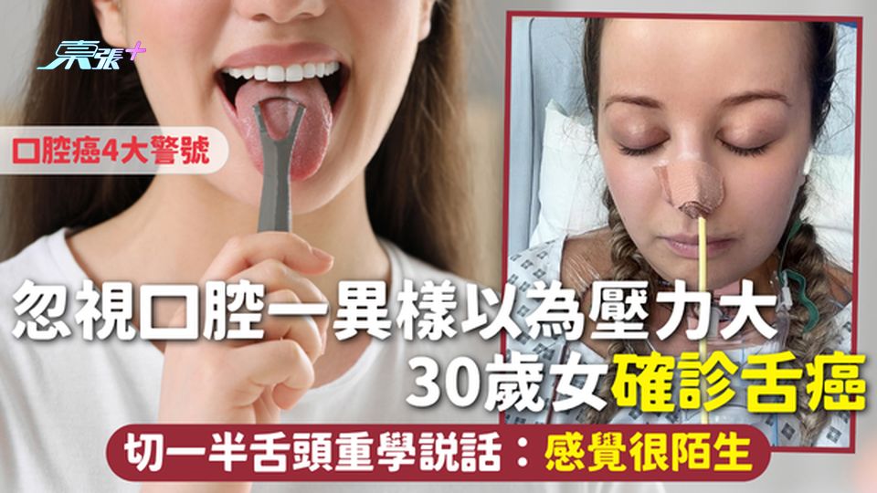 舌癌 | 忽視口腔一異樣以為壓力大 30歲女確診舌癌 切一半舌頭重學說話：感覺很陌生 口腔癌4大警號