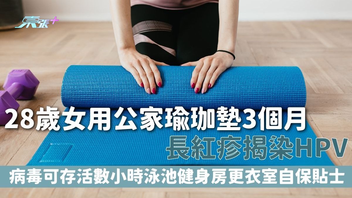 HPV病毒｜28岁女用公家瑜珈垫3个月 长红疹揭染HPV 病毒可存活数小时泳池健身房更衣室自保贴士