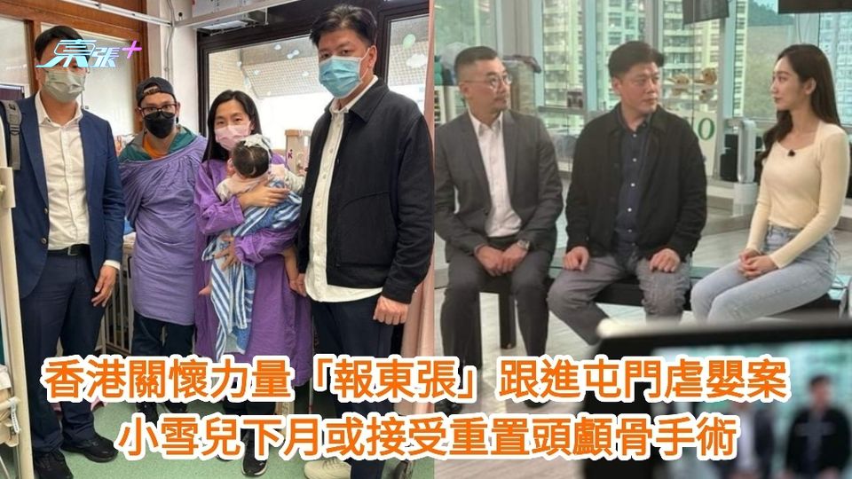 香港關懷力量「報東張」跟進屯門虐嬰案 小雪兒下月或接受重置頭顱骨手術