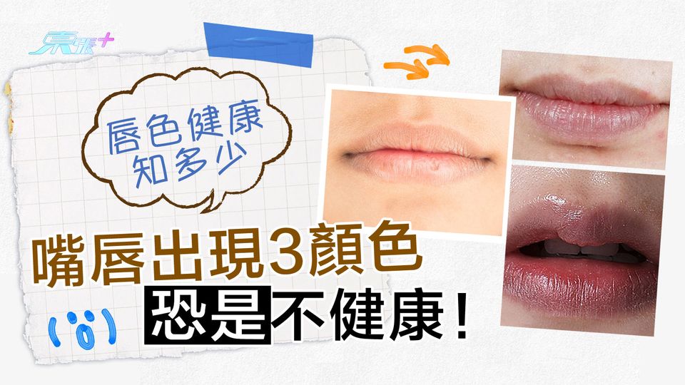唇色健康知多少 嘴唇出現三顏色恐是不健康！