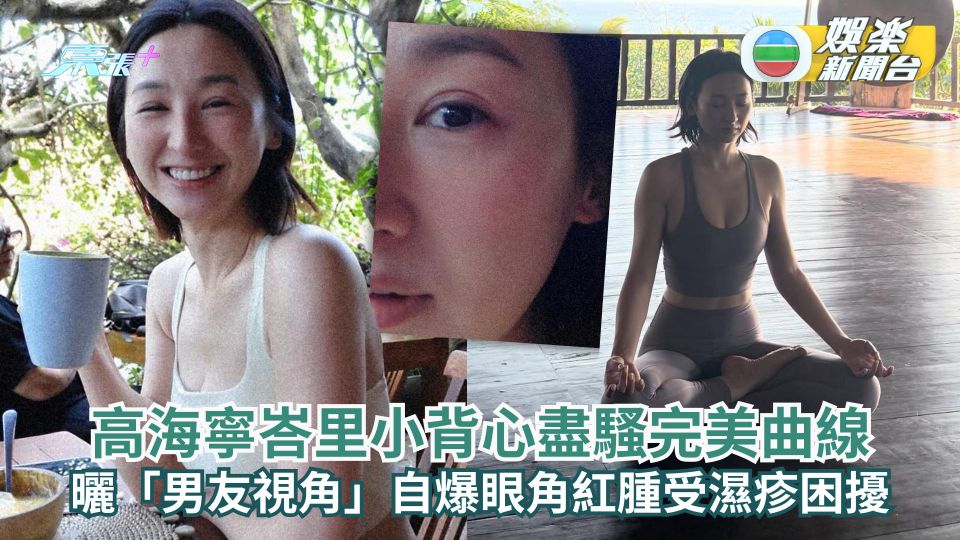 高海寧峇里小背心盡騷完美曲線 曬「男友視角」自爆眼角紅腫受濕疹困擾