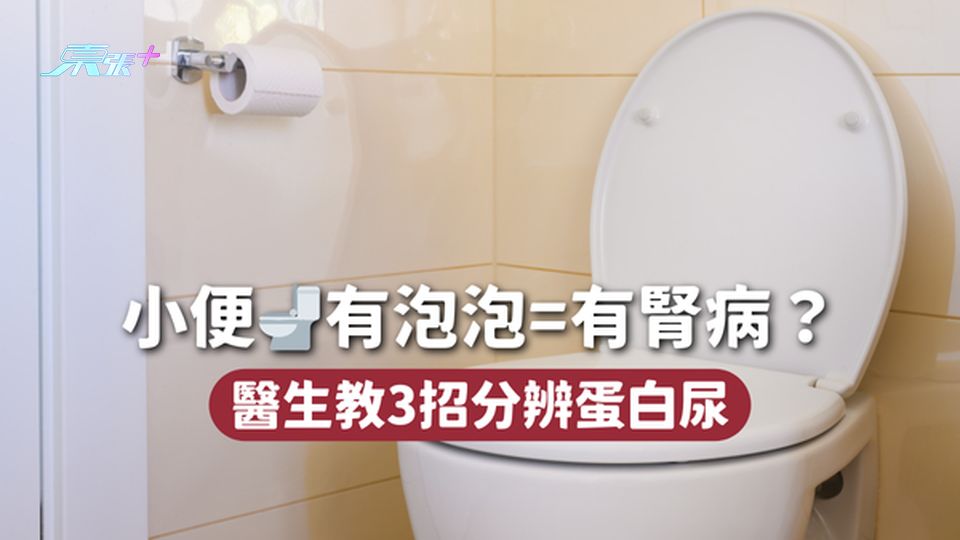 小便🚽有泡泡=有腎病？ 醫生教3招分辨蛋白尿
