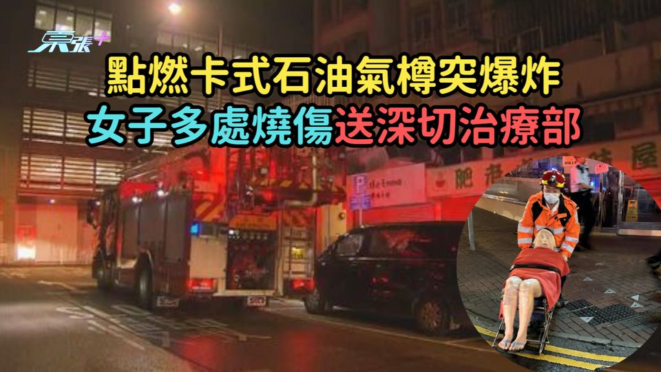 點燃卡式石油氣樽突爆炸  女子多處燒傷送深切治療部