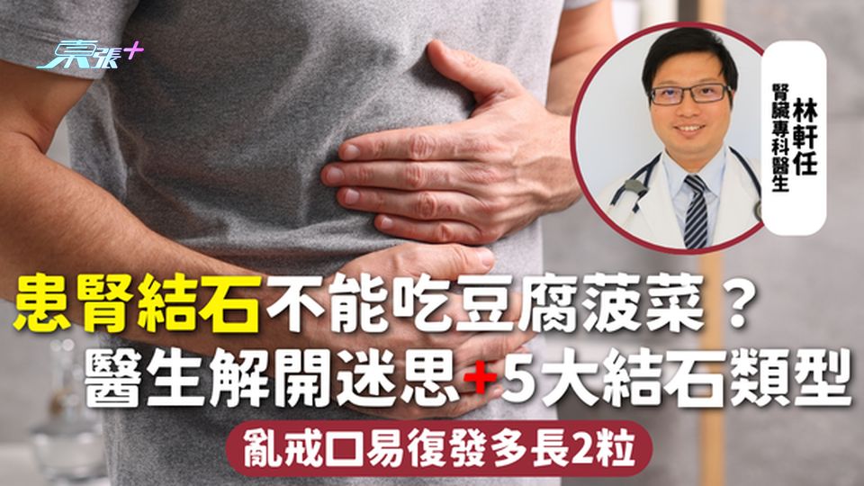 腎結石 | 患腎結石不能吃豆腐菠菜？醫生解開迷思+5大結石類型 亂戒口易復發多長2粒