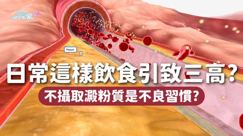 日常這樣飲食會引致三高！不攝取澱粉質原來也是不良習慣？